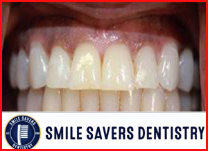 Smile-Savers-Dentistry-3.jpg